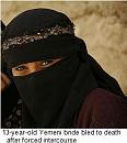 Click image for larger version

Name:	yemeni-child-bride-died-vaginal-injury.jpg
Views:	3622
Size:	13.7 KB
ID:	514267