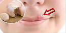 Click image for larger version

Name:	Get-Rid-Of-Herpes-Using-A-Simple-Trick.png
Views:	0
Size:	209.8 KB
ID:	678366
